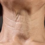 neck-treatments